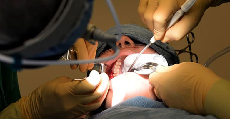 tooth extraction papatoetoe dental